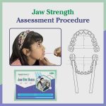 Jaw Bite Blocks